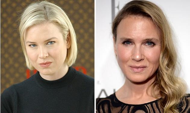 Η Renee Zellweger, δείχνει εντελώς διαφορετική… ξανά! Φωτογραφίες