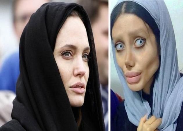 Σοκάρει η 19χρονη Ιρανή έχει κάνει 50 πλαστικές για να γίνει Angelina Jolie! [pics]