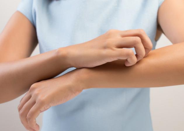 Ξέρεις γιατί ξύνεσαι όταν έχεις φαγούρα: Κοίτα τι γίνεται σε δέρμα και εγκέφαλο! [vid]