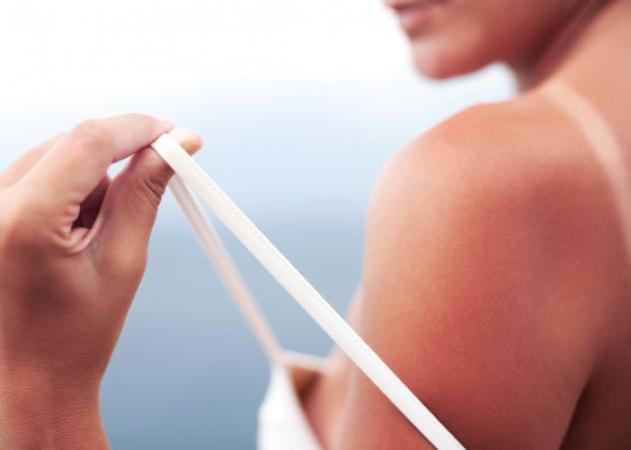 Ηλιακό έγκαυμα: 9 μύθοι και αλήθειες που ΠΡΕΠΕΙ να διαβάσεις!