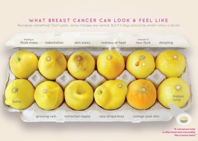 Καρκίνος του μαστού: Γιατί αυτή η φωτογραφία με λεμόνια έγινε viral στο facebook!