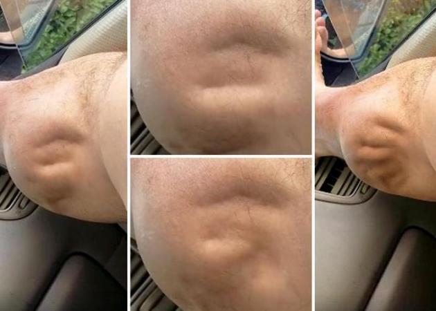 Η… εξωγήινη κράμπα που έγινε viral – Κοίτα πώς γίνεται το πόδι του! [vid]