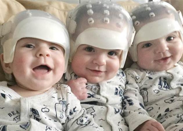 Αυτά είναι “τα πιο σπάνια τρίδυμα” στην ιστορία της Ιατρικής – Κοίτα γιατί!