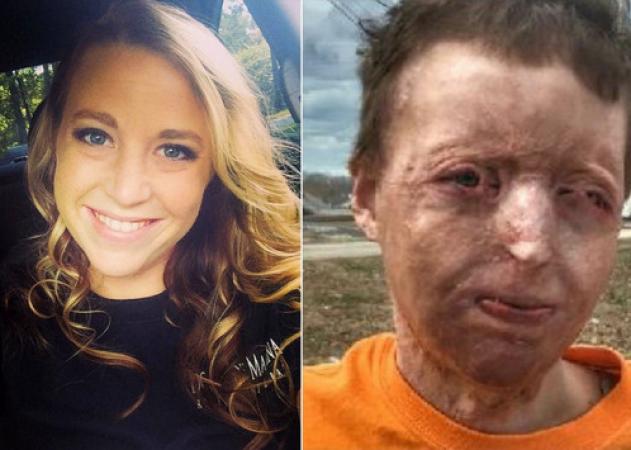 “Ένιωθα πως πεθαίνω” – Το ατύχημα που άλλαξε όλη της τη ζωή