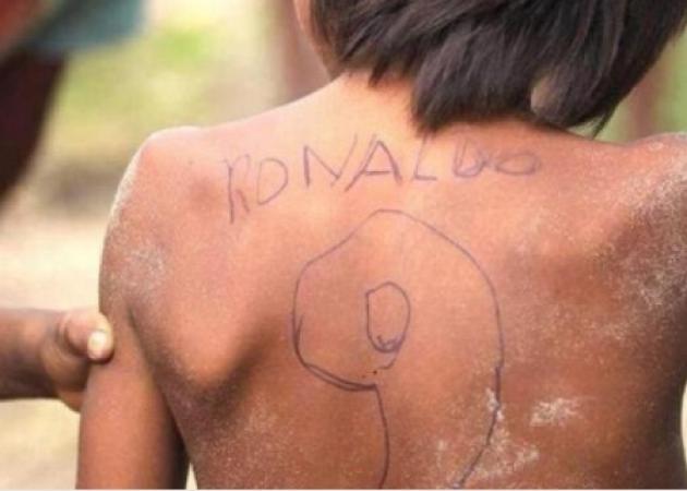 Ραγίζει καρδιές ο φτωχός… Ρονάλντο! Ο πιτσιρικάς που μας βάζει να σκεφτούμε διπλά [pic]