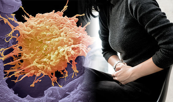 Καρκίνος του τραχήλου της μήτρας: Τα σημάδια ότι η θανατηφόρα ασθένεια έχει προχωρήσει