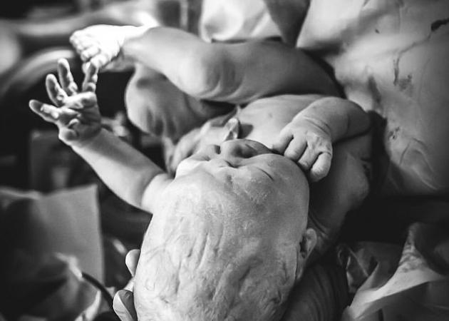 Δες πώς γίνεται το κεφάλι ενός μωρού στην γέννα! [pics, vid]