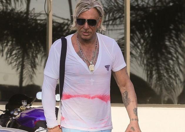 Ο Mickey Rourke ποζάρει με τον πλαστικό χειρουργό του, αμέσως μετά την πλαστική! [pics]