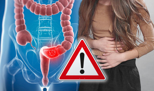 Καρκίνος του παχέος εντέρου: Πέντε σημάδια ότι ΠΡΕΠΕΙ να σας δει γιατρός