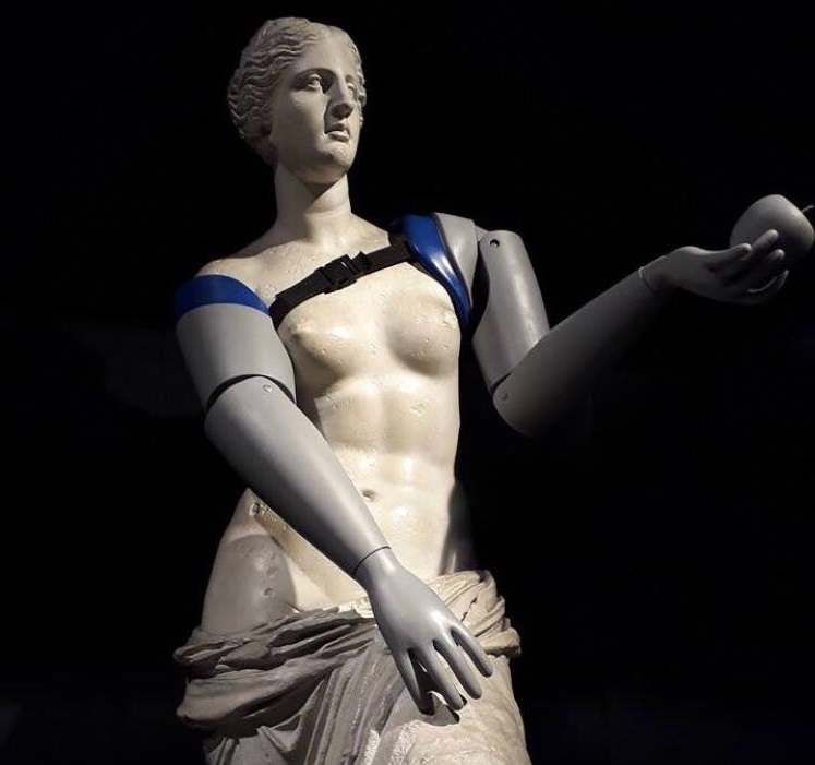 Παρίσι: Προσθετικά μέλη στην Αφροδίτη της Μήλου στο Παρίσι για την ευαισθητοποίηση του κοινού