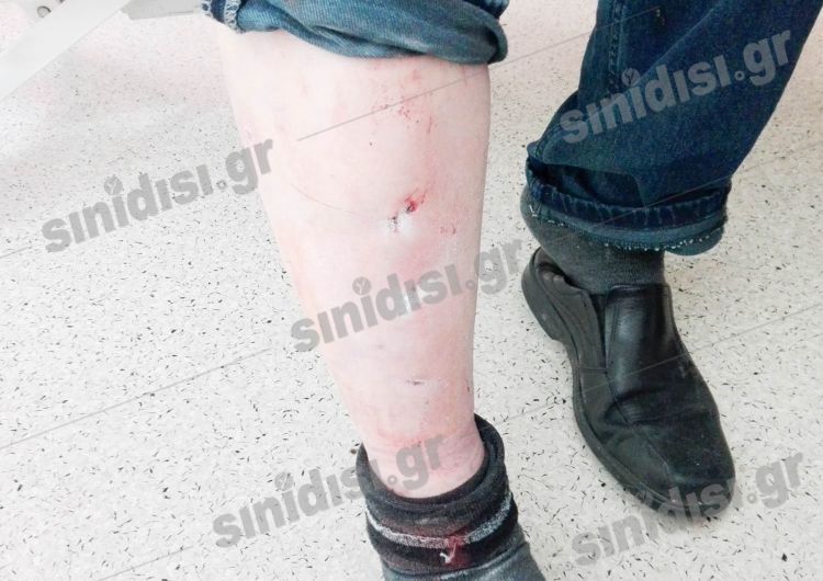 Αγρίνιο: Μαρτύριο στα χέρια ληστών – Σακάτεψαν τα δύο αδέρφια στο ξύλο