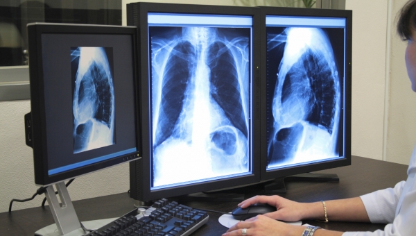 Ανακαλύφθηκε νέο όργανο στο ανθρώπινο σώμα! Ίσως είναι το κλειδί στην καταπολέμηση του καρκίνου