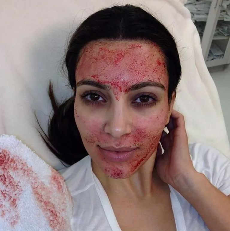 Η Kim Kardashian μίλησε για την χειρότερη beauty εμπειρία που είχε ποτέ!