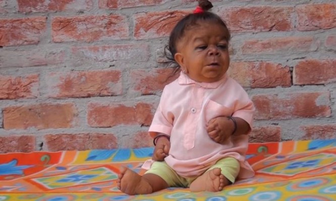 Είναι 23 χρόνων και “ζει σε σώμα μικρού παιδιού” – Οι ντόπιοι τον θεωρούν… μετενσάρκωση θεού! [vid]