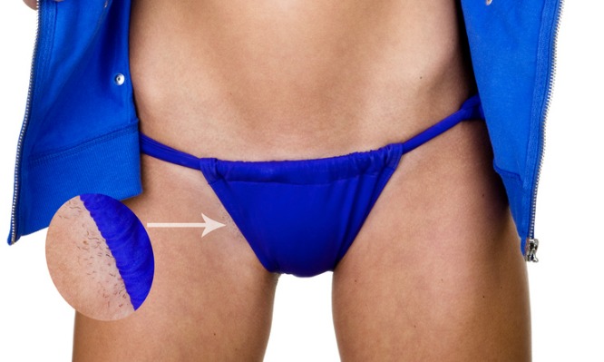 Ξύρισμα στο μπικίνι: Κίνδυνος μόλυνσης αν δεν προσέχεις