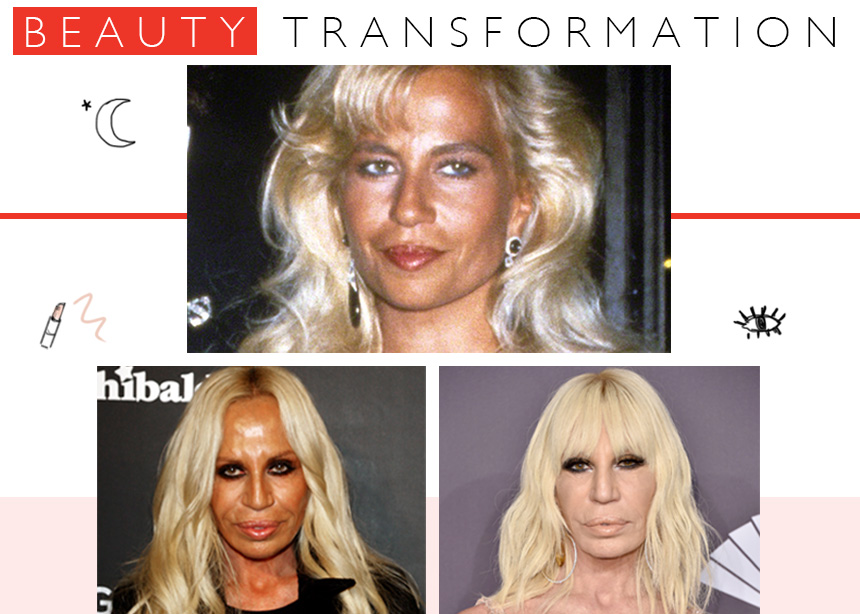 Donatella Versace: η μεταμόρφωσή της από το 1992 μέχρι σήμερα!