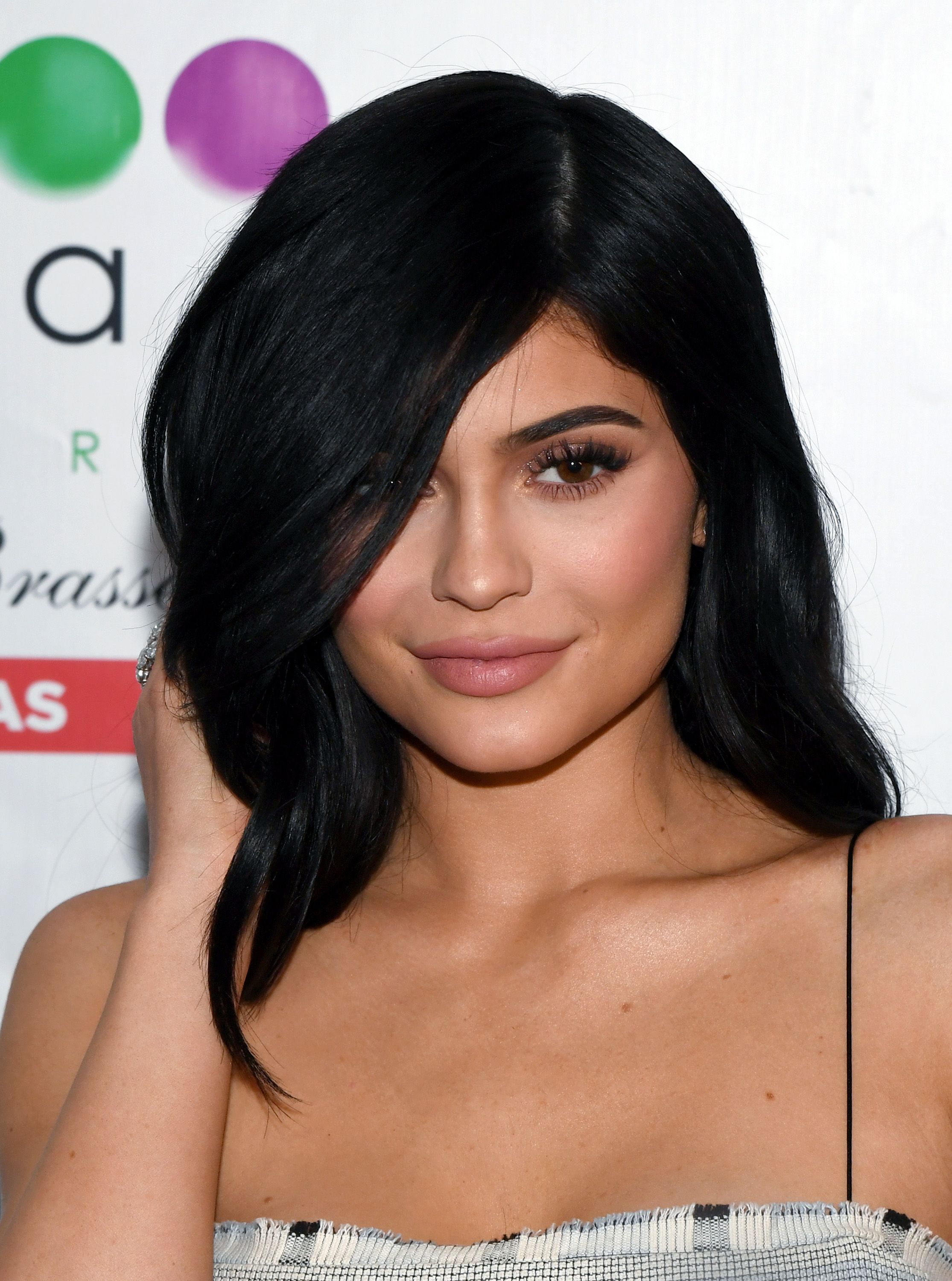 Η Kylie Jenner έβγαλε τα filler από τα χείλη της!