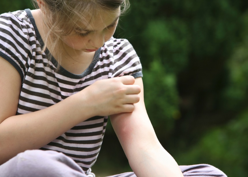 Τα κουνούπια δεν πάνε διακοπές: Ο Δρ. Μαζάνης προτείνει τρόπους προστασίας για τα παιδιά