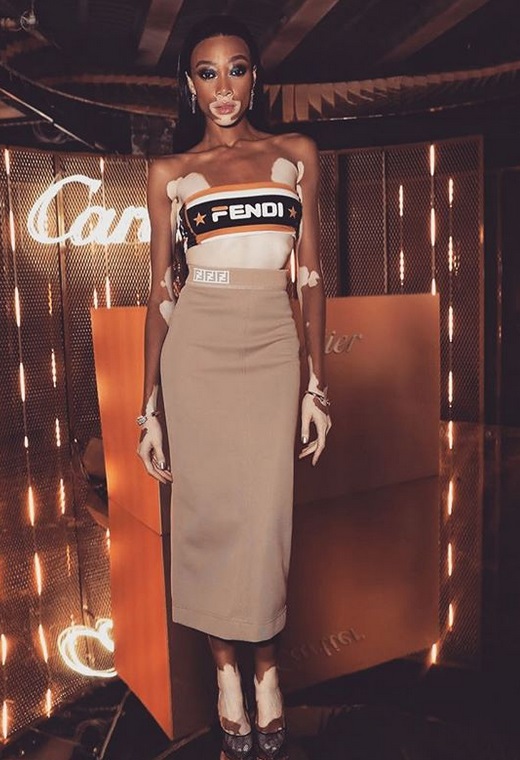 Η Winnie Harlow με Fendi