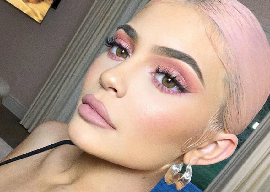 Η Kylie Jenner έβαλε ξανά filler στα χείλη της!