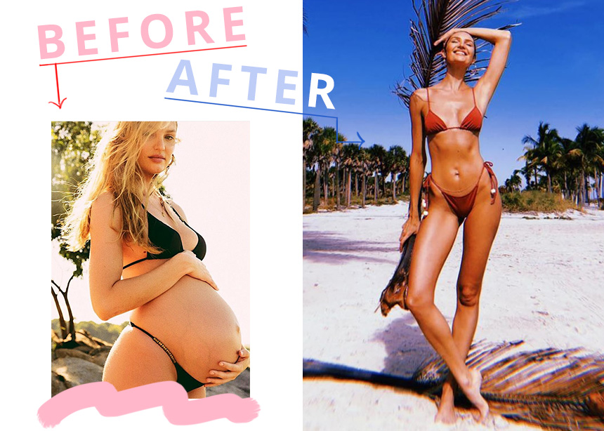 Candice Swanepoel: Ο Άγγελος Victoria’s Secret αποκαλύπτει πως έχασε τα κιλά της εγκυμοσύνης σε 5 μήνες