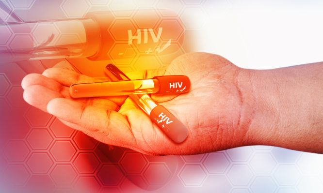 AIDS: ΣΤΟΠ στην μετάδοση του ιού HIV από τον ένα ασθενή στον άλλο