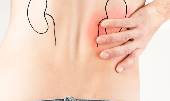 Κολικός νεφρού: Συμπτώματα και αντιμετώπιση