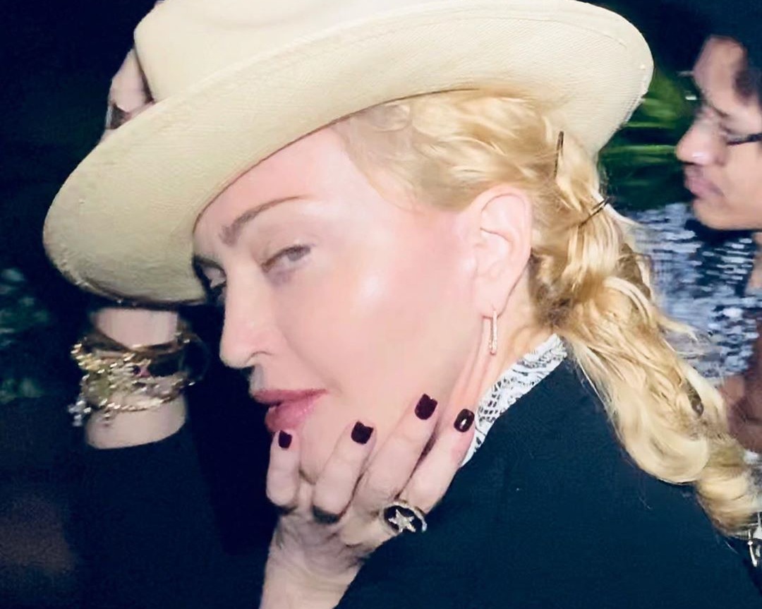 Madonna: Tι συμβαίνει με την υγεία της; Το μπαστούνι και τα μπάνια σε παγάκια! video