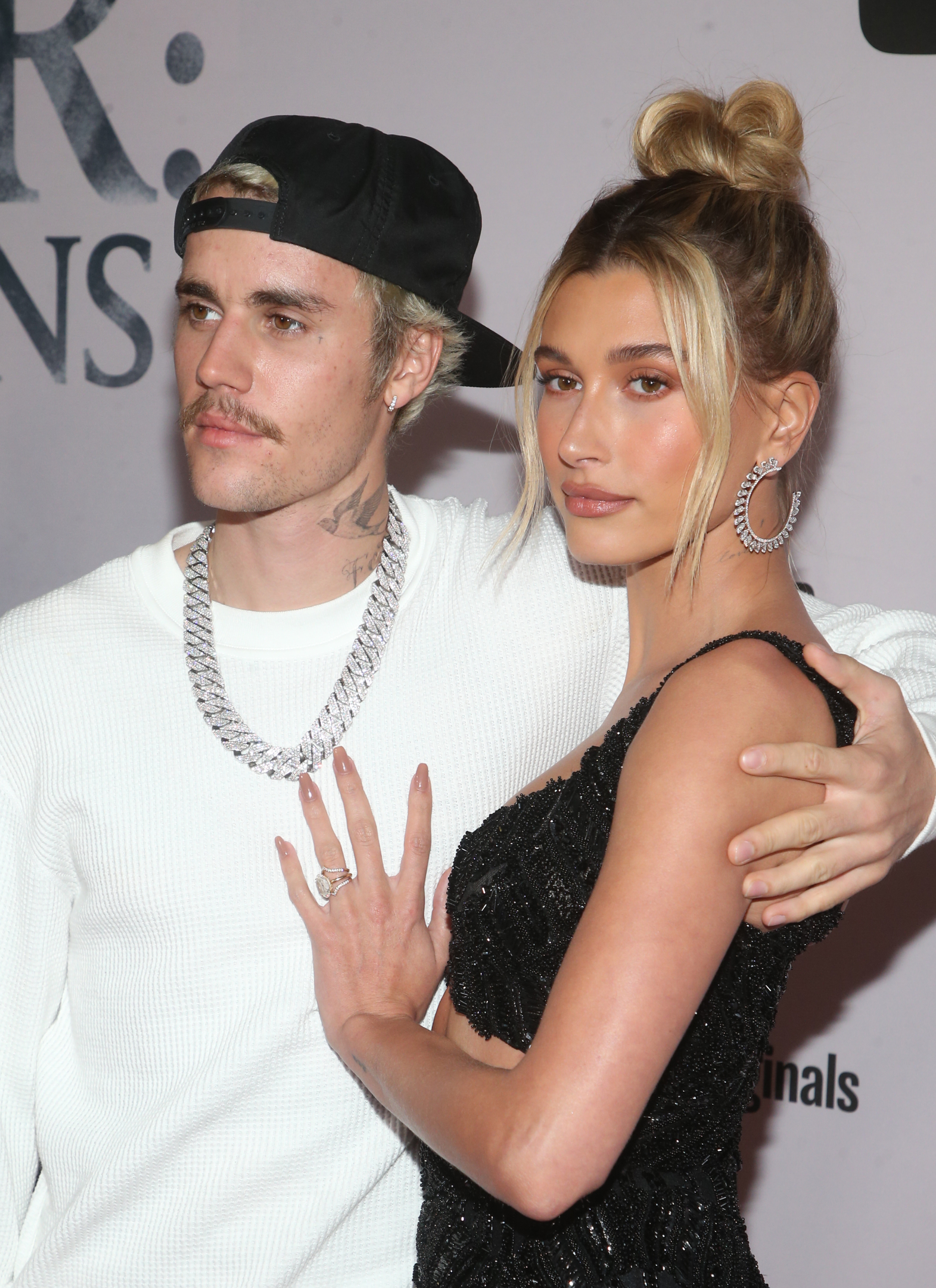 H Hailey Bieber βοηθά τον σύζυγό της, Justin Bieber, να απαλλαγεί από την ακμή (αλλά με τον λάθος τρόπο)!