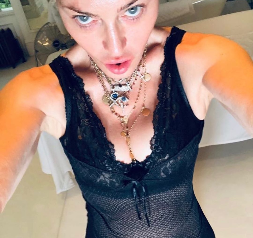 Madonna: Ετοιμάζεται για θεραπεία και μας δείχνει τα… οπίσθιά της πυροδοτώντας τη φήμη για πλαστική! [pics]