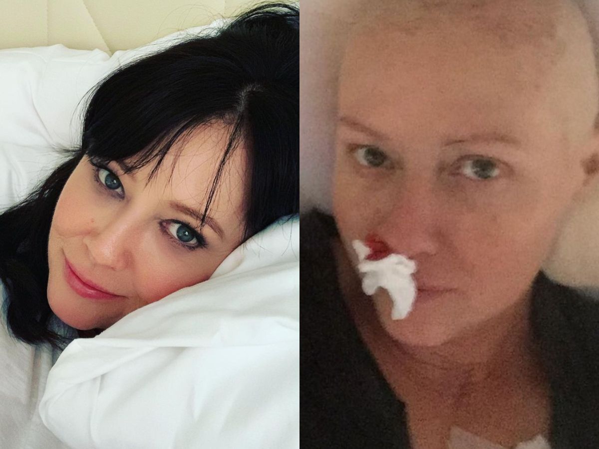 Σάνεν Ντόχερτι: Σοκάρουν οι νέες φωτογραφίες από τη μάχη της με τον καρκίνο – «Αληθινές, όχι όμορφες»