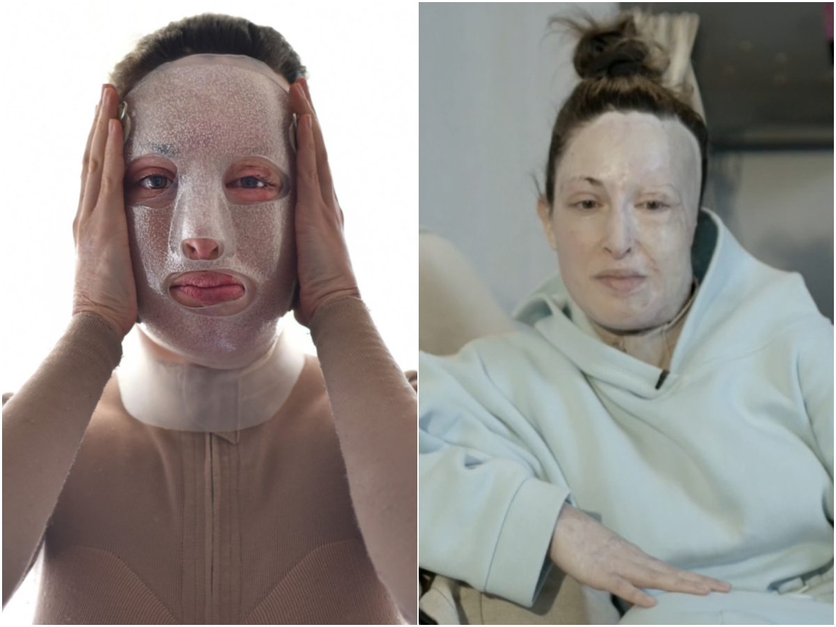 Ιωάννα Παλιοσπύρου – Πρωταγωνιστές: Οι εικόνες σοκ από το χειρουργείο – Χωρίς μάσκα περιγράφει τις φρικτές μέρες στο νοσοκομείο