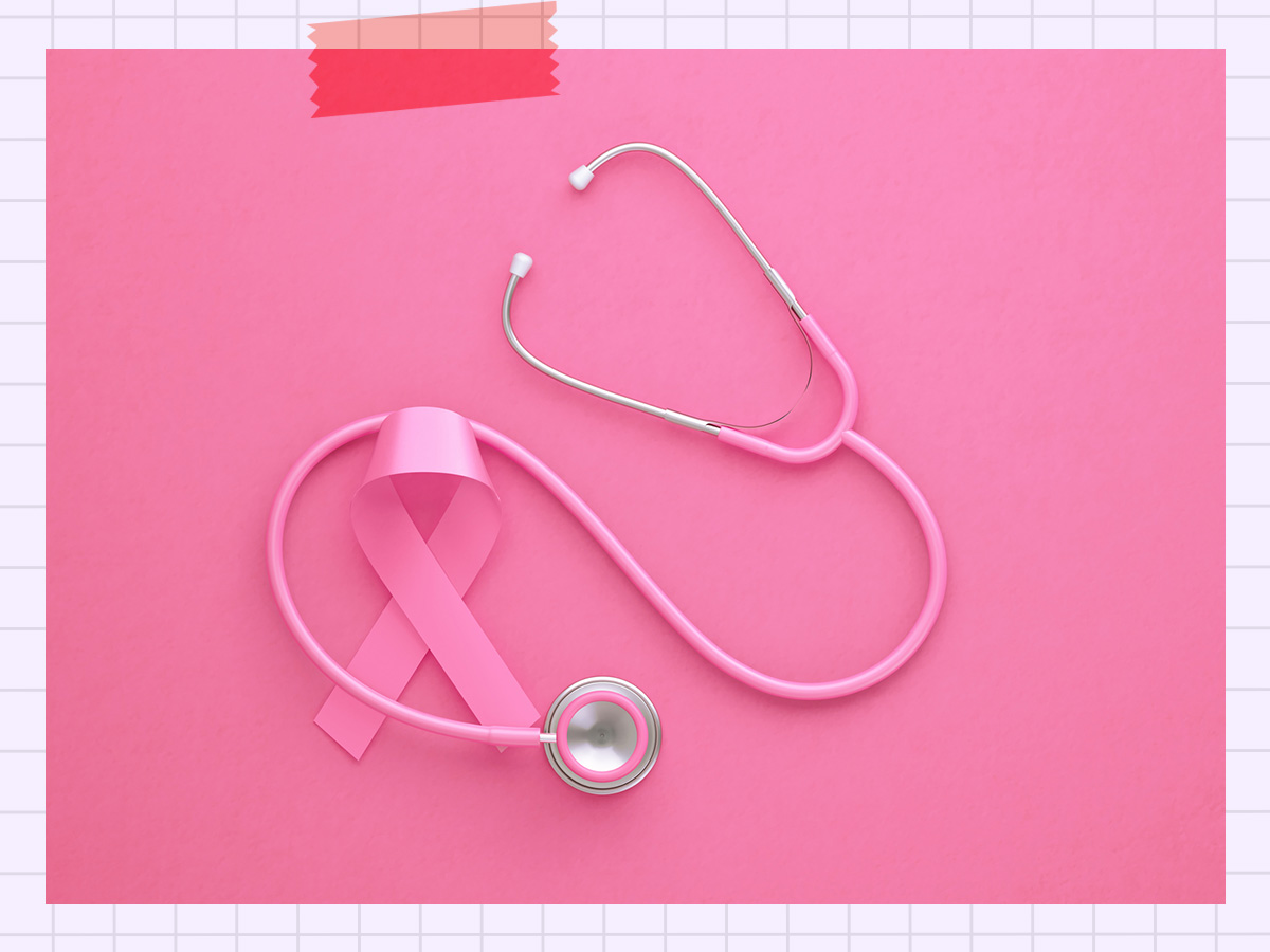 PRS: Η εξέταση που μπορεί να προβλέψει τον κίνδυνο καρκίνου του μαστού, χρόνια πριν την εμφάνιση της νόσου