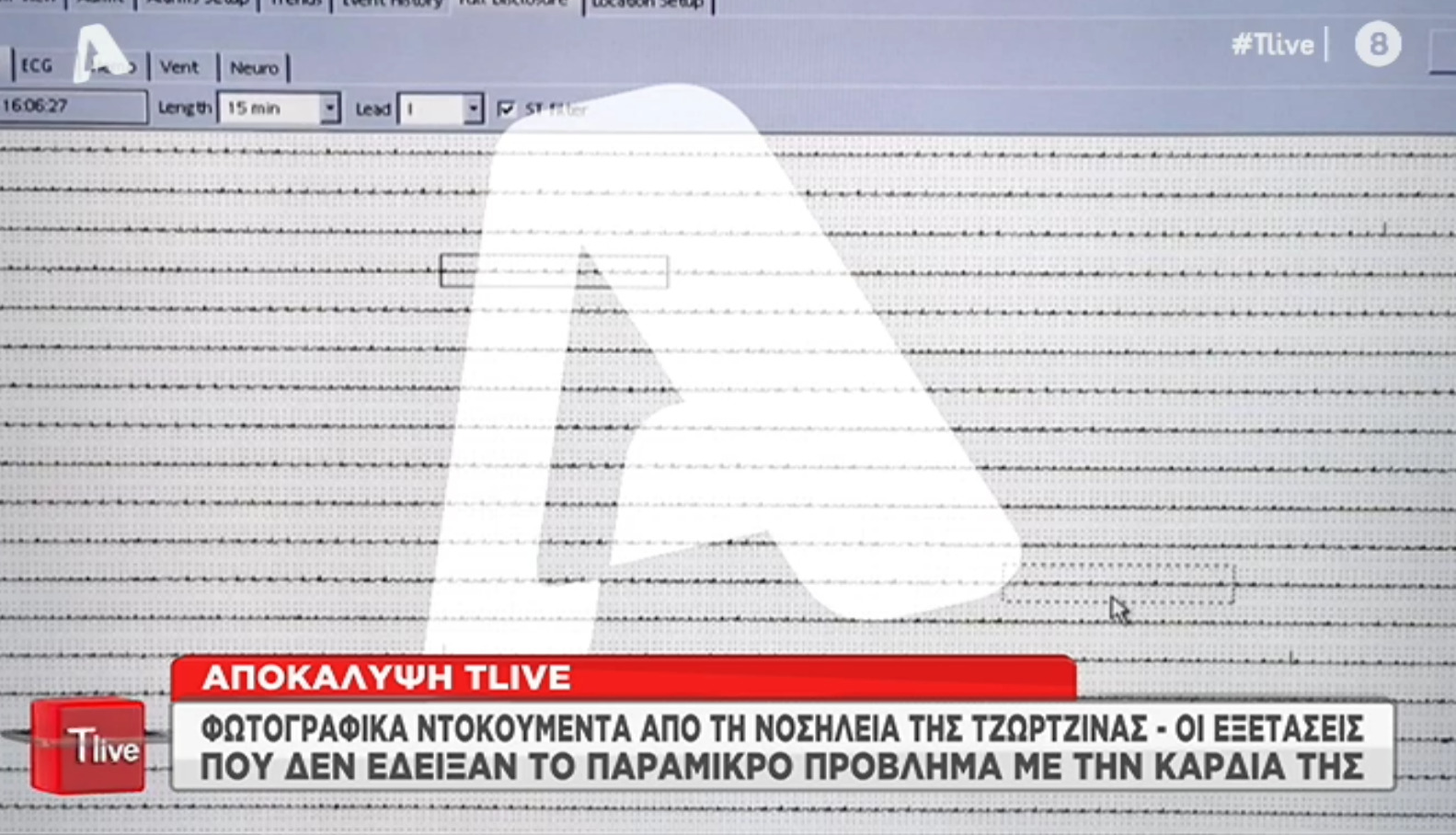 Πάτρα: Φωτογραφικά ντοκουμέντα από τη νοσηλεία της Τζωρτζίνας – Τα μηνύματα της Ρούλας Πισπιρίγκου σε γιατρό