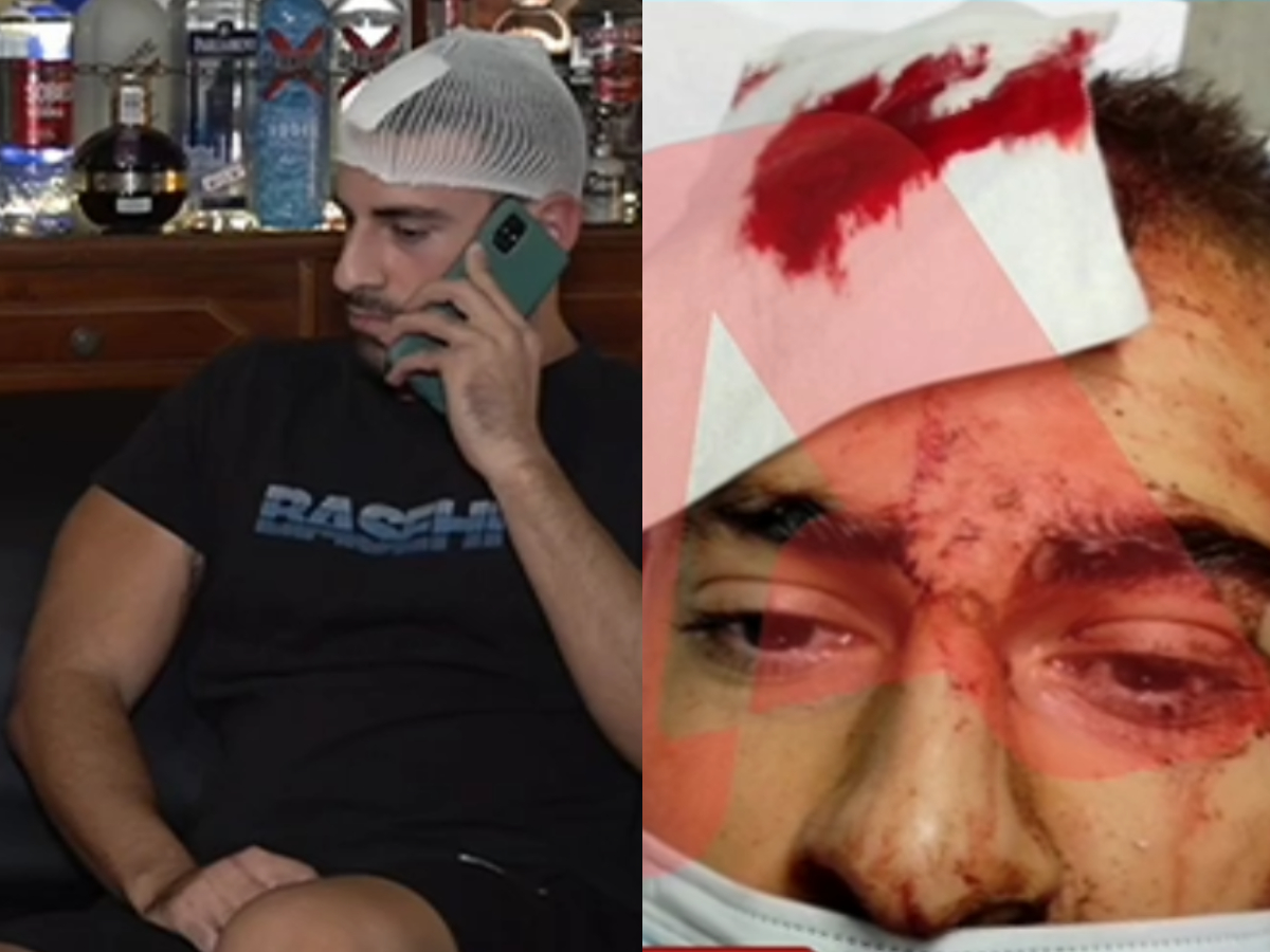 Ατύχημα σε λούνα παρκ: Συγκλονίζει ο 25χρονος για τον τραυματισμό του – «Έχασα τις αισθήσεις μου και δεν θυμάμαι τίποτα»