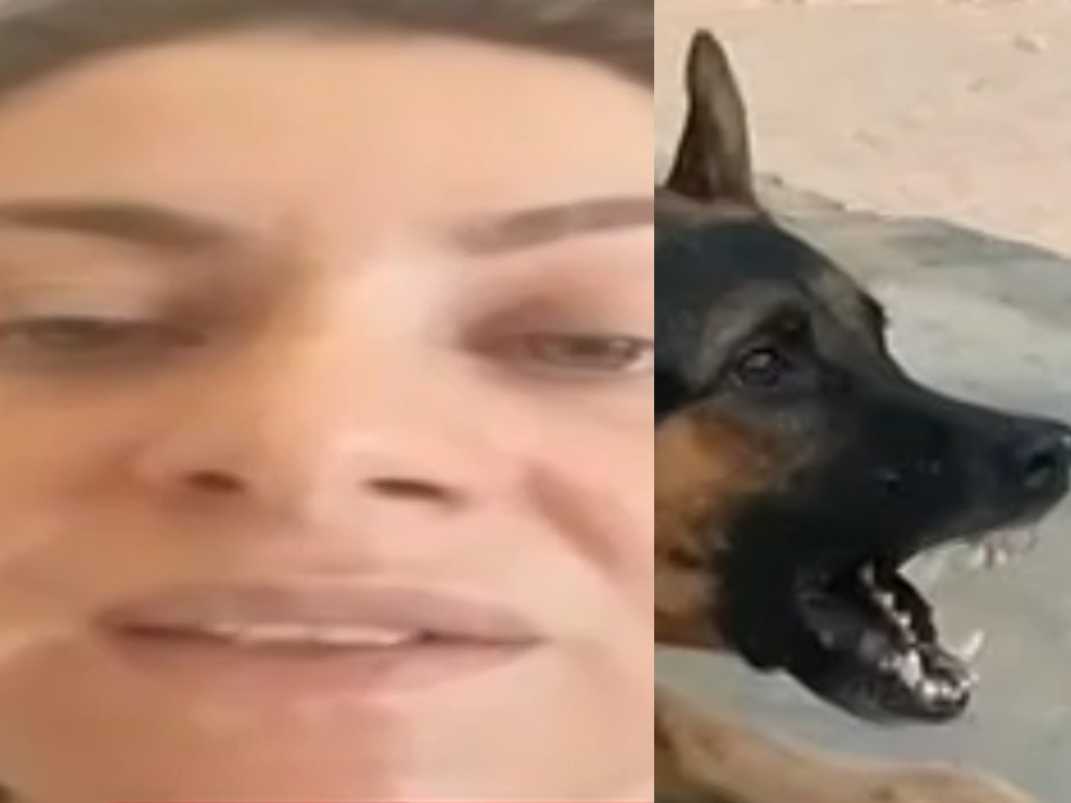 Σοκάρει η 34χρονη που δέχτηκε επίθεση σκύλων έξω από τη δουλειά της – «Έπεσαν πάνω μου και με καταδάγκωναν»