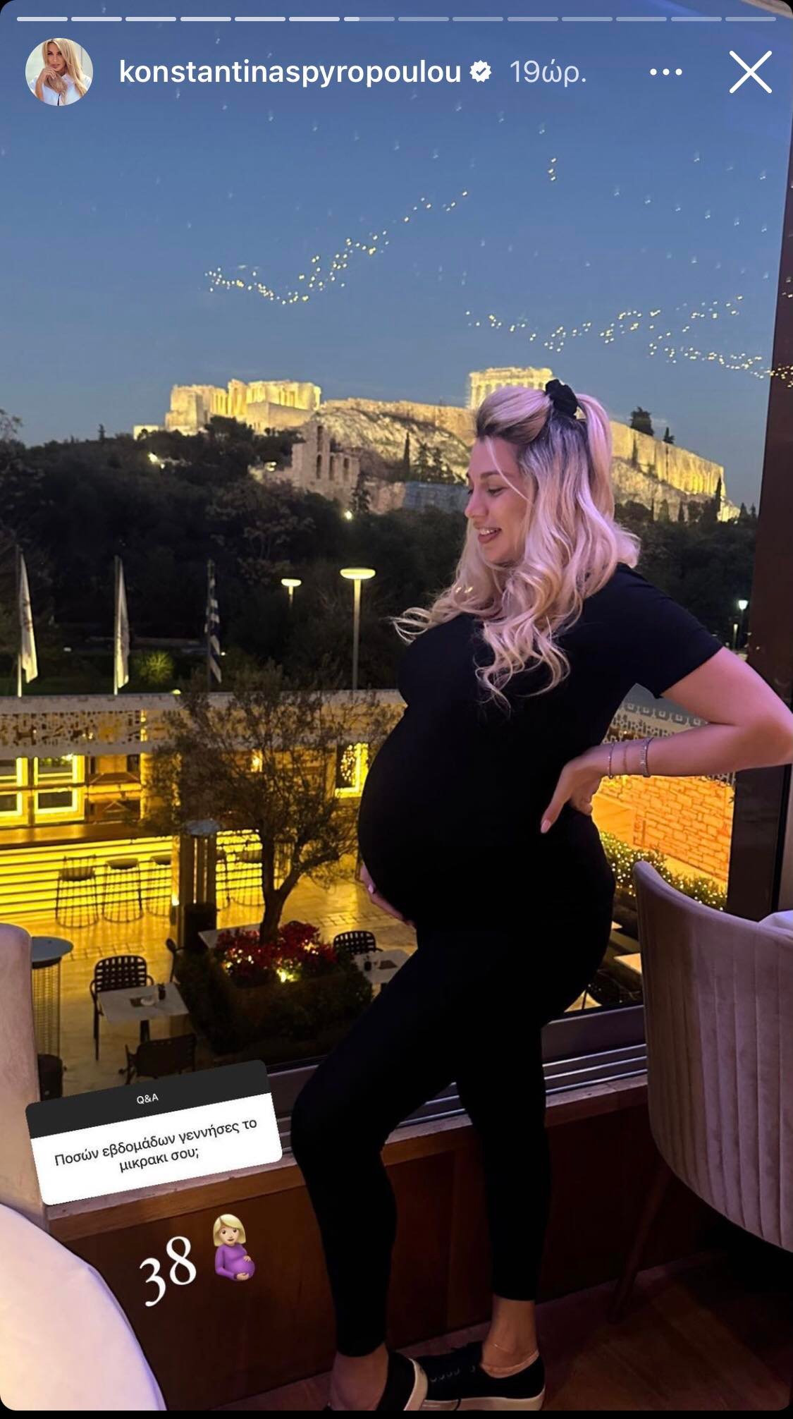 Κωνσταντίνα Σπυροπούλου: Οι μεταβολές στην ψυχολογία της μετά τον τοκετό, τα κιλά της εγκυμοσύνης και το ατύχημα