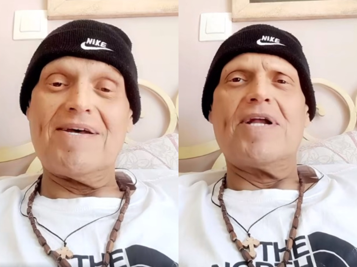 Συγκλονίζει ο Γιώργος Δασκαλάκης: Συνεχίζει να δίνει μάχη με τον καρκίνο και δείχνει τις ουλές στο σώμα του