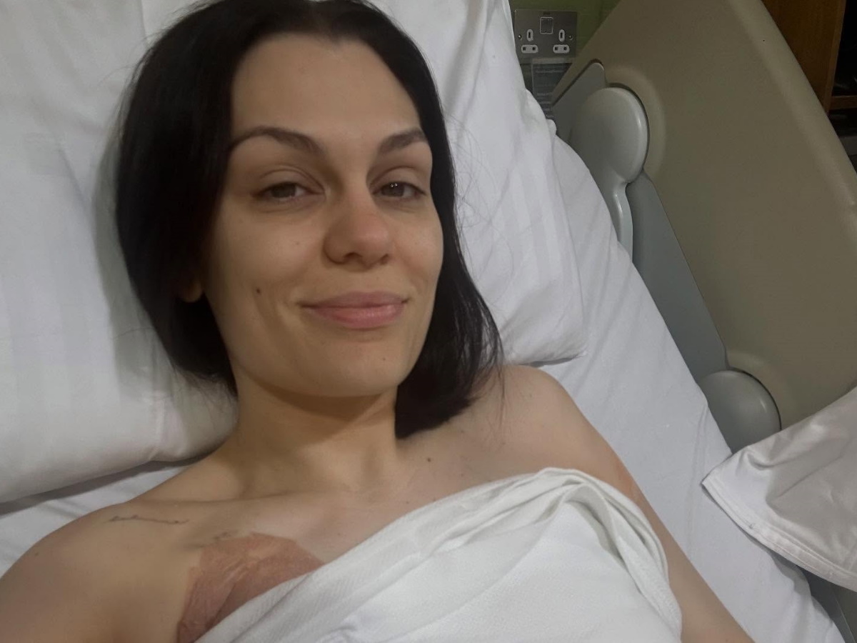Jessie J: Θα υποβληθεί σε δεύτερη επέμβαση για τον καρκίνο του μαστού – «Το σώμα μου ψάχνει τον ρυθμό του»