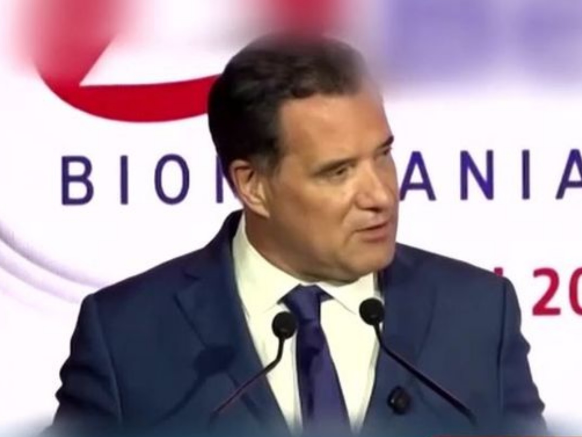 Άδωνις Γεωργιάδης: Η απάντηση για τις παρεμβάσεις που έχει κάνει – «Έβαλα μαλλιά και έκανα μπότοξ»