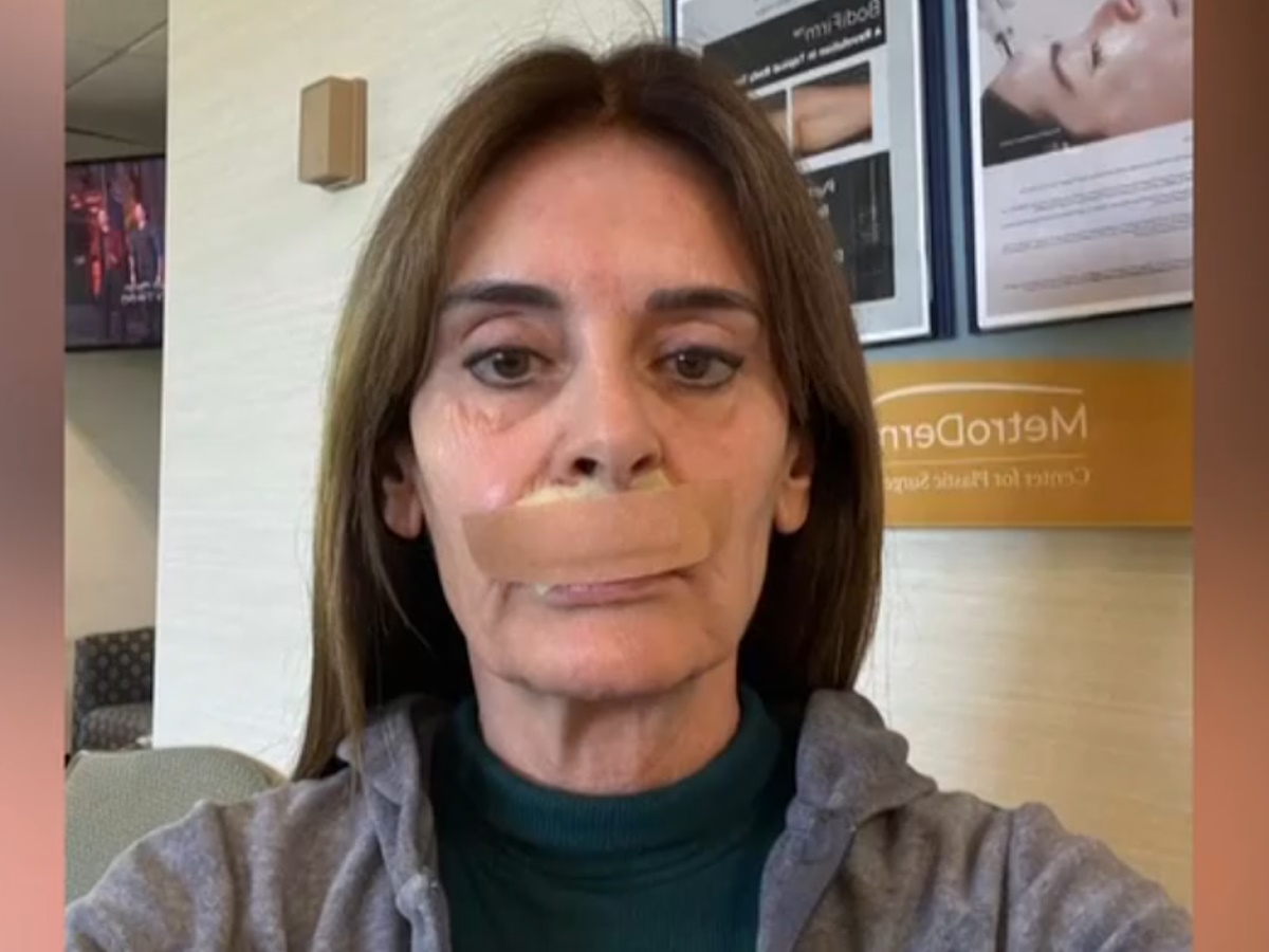 Κατερίνα Πλουμιδάκη: «Έκανα το 21ο χειρουργείο, πήραν λίπος από τον γοφό για να μου φτιάξουν τα χείλη»